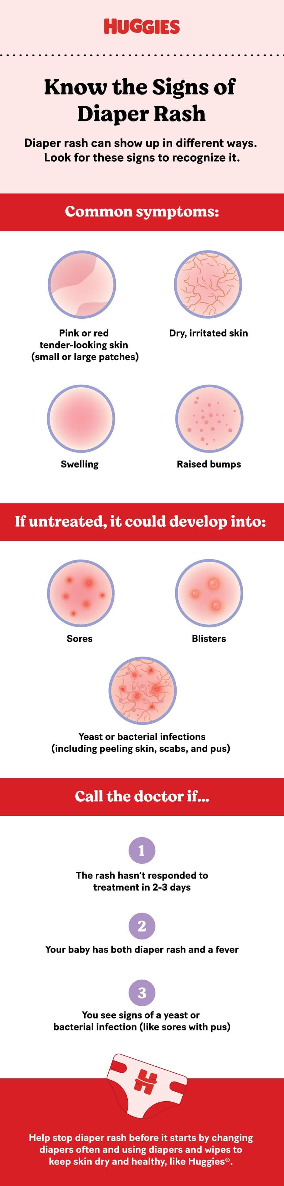 diaper rash visual guide